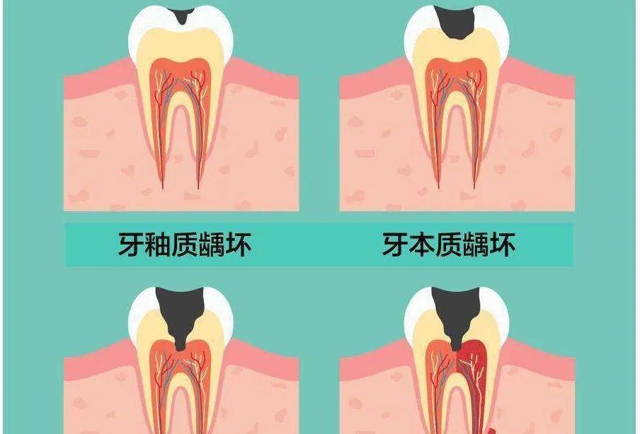 仙人球身上长黑点是什么？黑点的成因及解决方法？